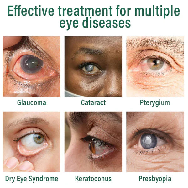 LUMIVO™ Nano Eye Drops Serum ✅FDA Approved(Suitable for presbyopia, dry eye syndrome, glaucoma, and cataracts) ☘️☘️