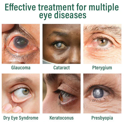 LUMIVO™ Nano Eye Drops Serum ✅FDA Approved(Suitable for presbyopia, dry eye syndrome, glaucoma, and cataracts) ☘️☘️