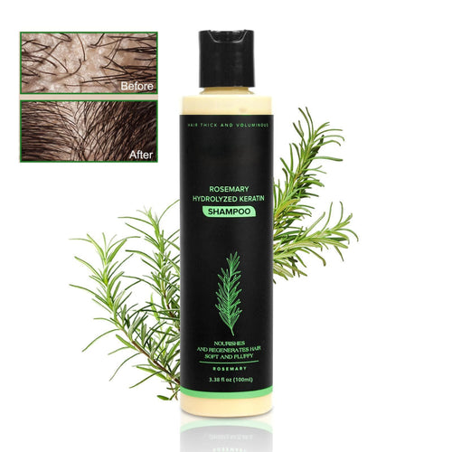 🔥LAST DAY 50% OFF -  Hair Growth Shampoo