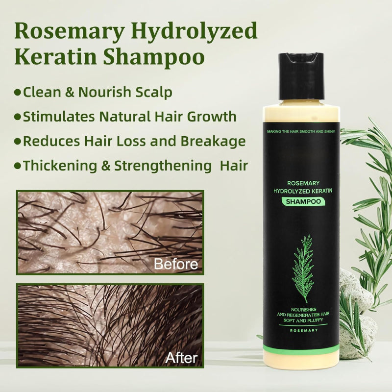 🔥LAST DAY 50% OFF -  Hair Growth Shampoo