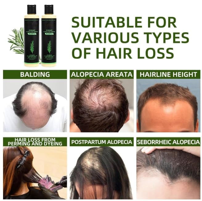 🔥LAST DAY 50% OFF -  Hair Growth Shampoo