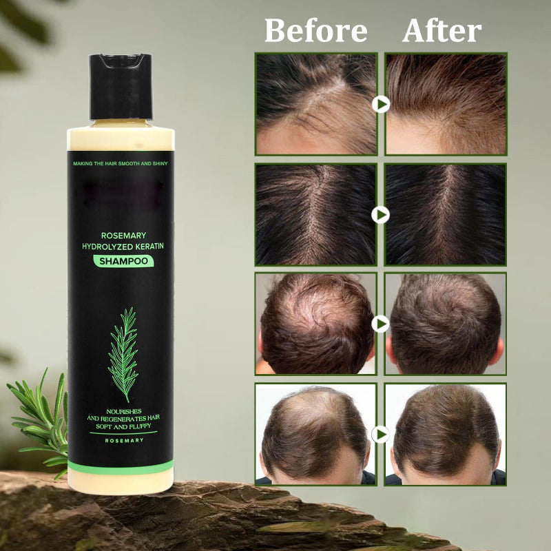 🔥LAST DAY 50% OFF -  Hair Growth Shampoo