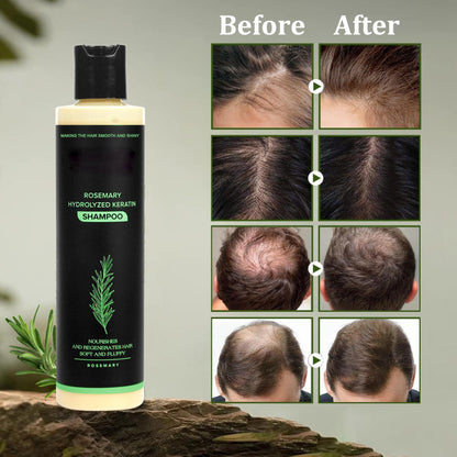 🔥LAST DAY 50% OFF -  Hair Growth Shampoo